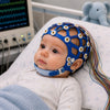 Casque EEG réutilisable à 8 canaux pour nouveau-nés, doté de la technologie CNSAC, destiné au diagnostic clinique par EEG