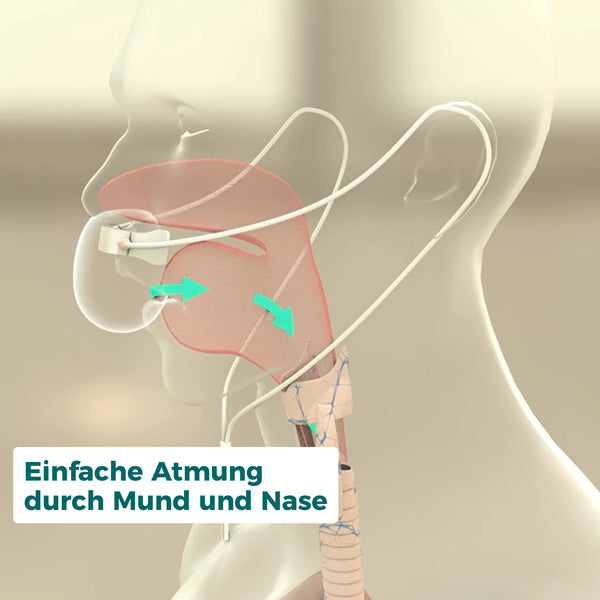 NasalOxy - Mund- und Nasenatmung für COPD-Patienten